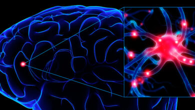 Photo of Día de Conciencia sobre la Epilepsia