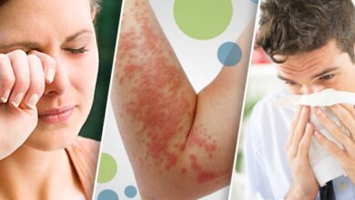 Photo of Día Mundial de la Alergia: una fecha para crear conciencia sobre la prevención