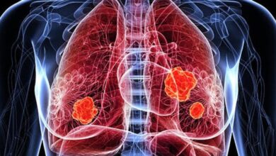Photo of Día Internacional de la Lucha contra el Cáncer de Pulmón