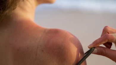 Photo of Protección de la piel, clave en Semana Santa