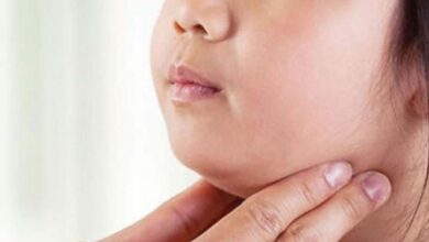 Photo of Salud reporta 27 casos confirmados de parotiditis